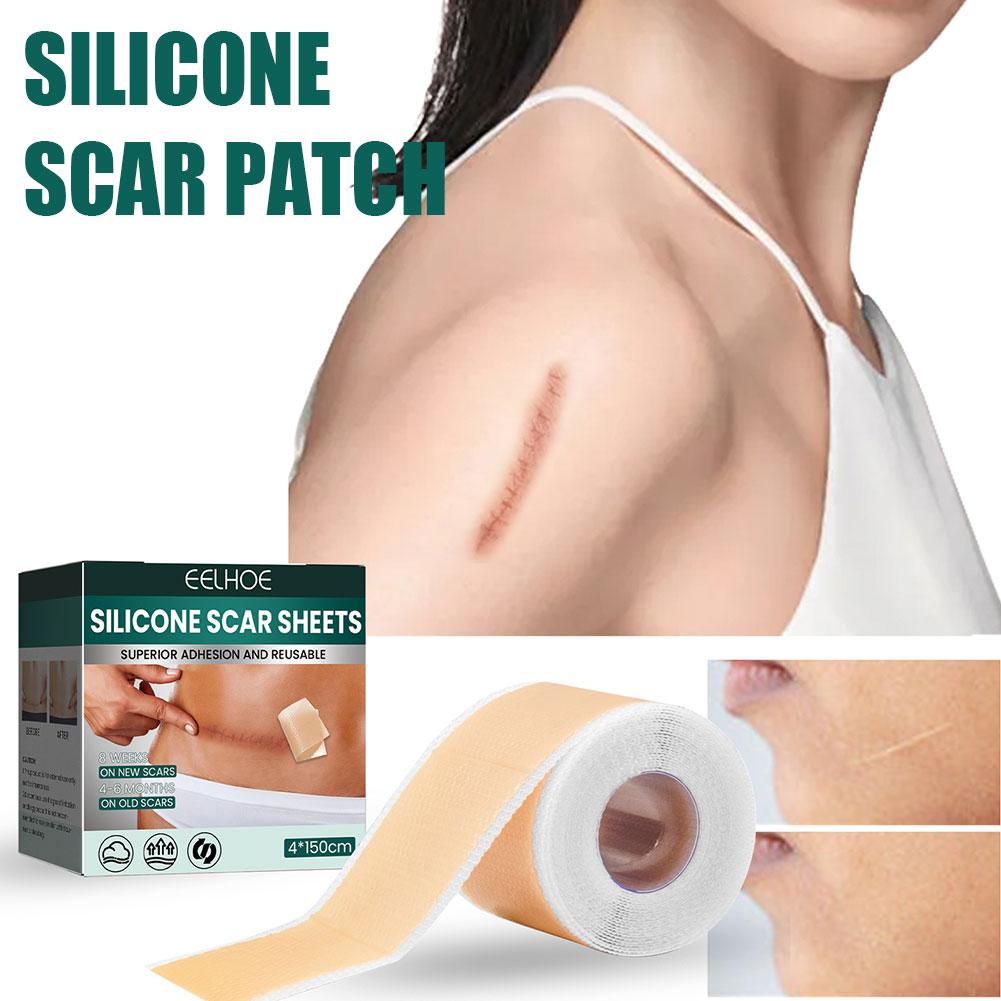 Silicone Scar Tape